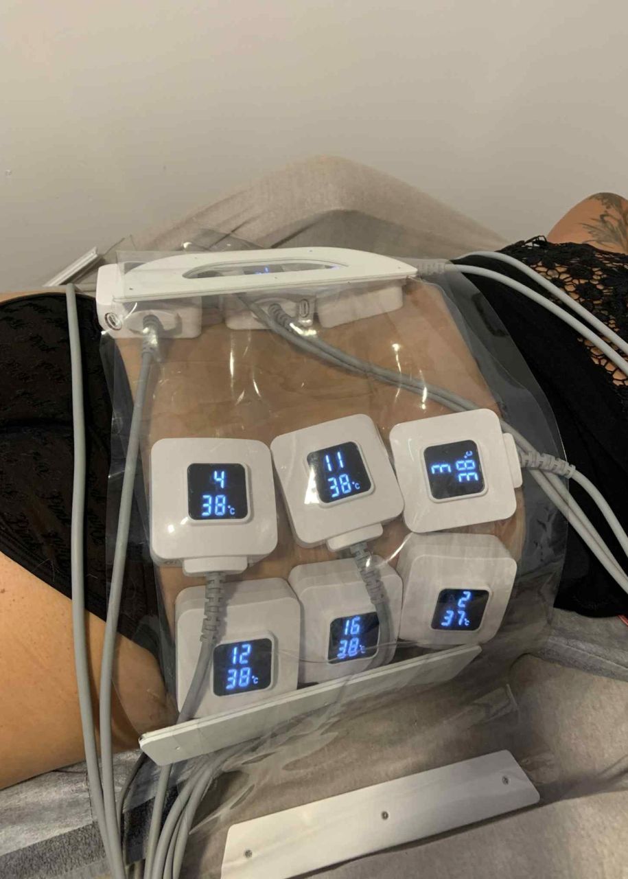 Monosculpt ONE Alakformáló és Zsírbontó Gép 